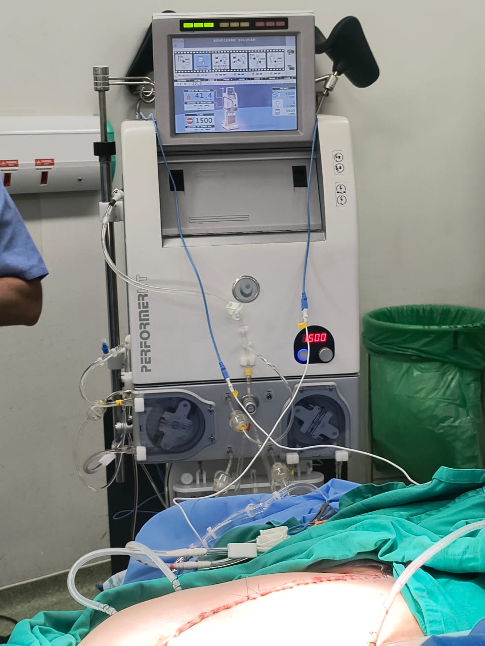 HIPEC (Quimioterapia Intraperitoneal Hipertérmica)